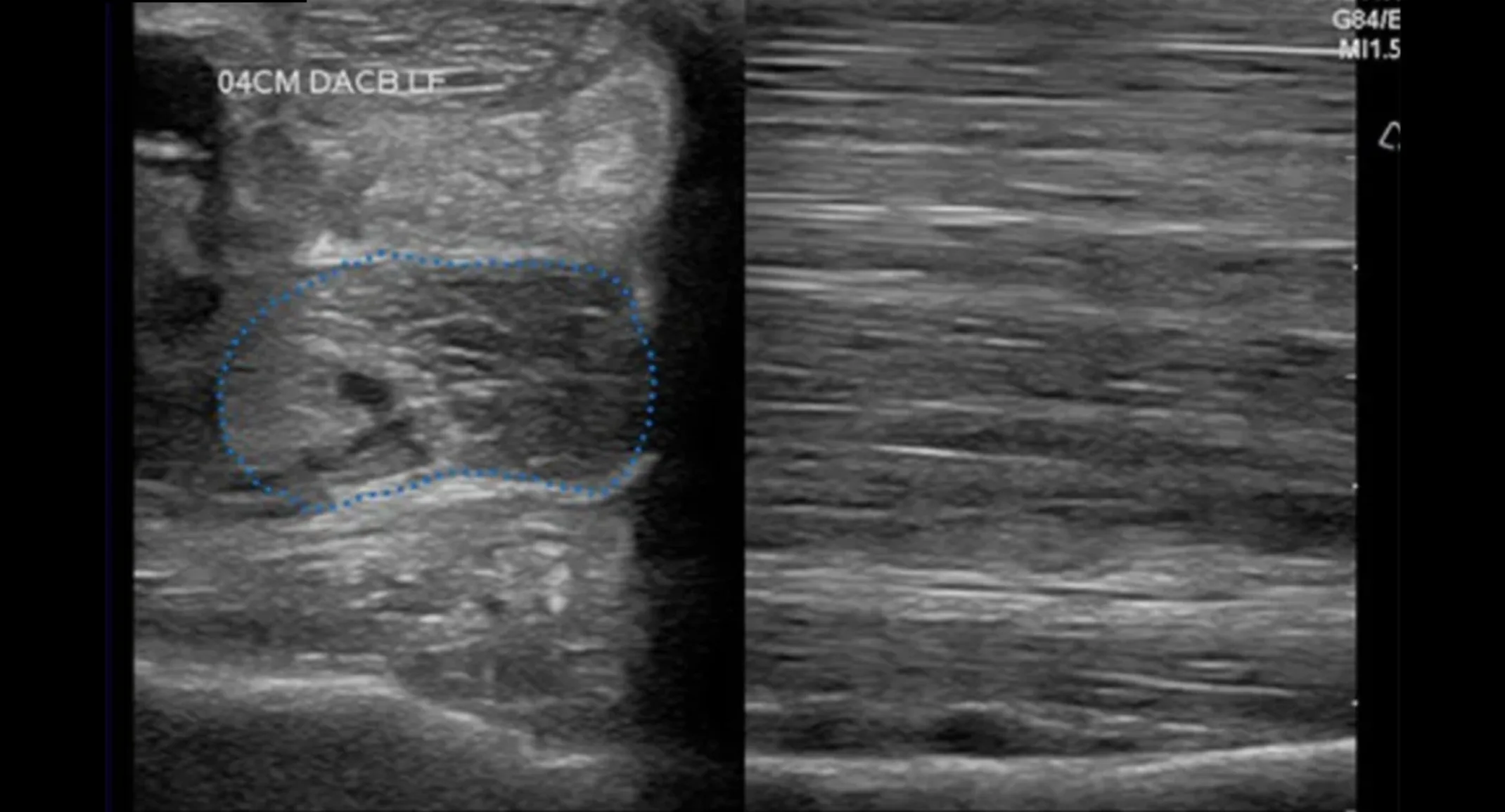 Ultrasound of a Horse with Ligament Injury